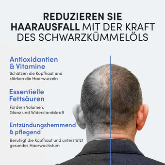 Ein Mann mit lichtem Haar von hinten, daneben Text zu Premium Schwarzkümmelöl von Dr. Balwi Shop: Schützt die Kopfhaut, beugt Haarausfall vor und verleiht mehr Volumen dank pflegender Fettsäuren und Antioxidantien.