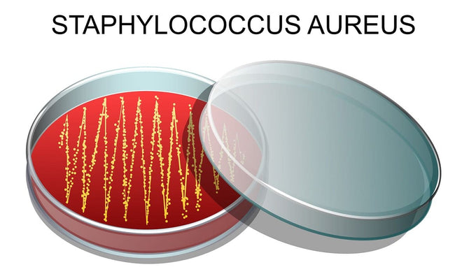 Hair loss caused by Staphylococcus aureus - What to do?
