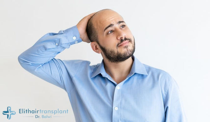 Hair loss on vacation