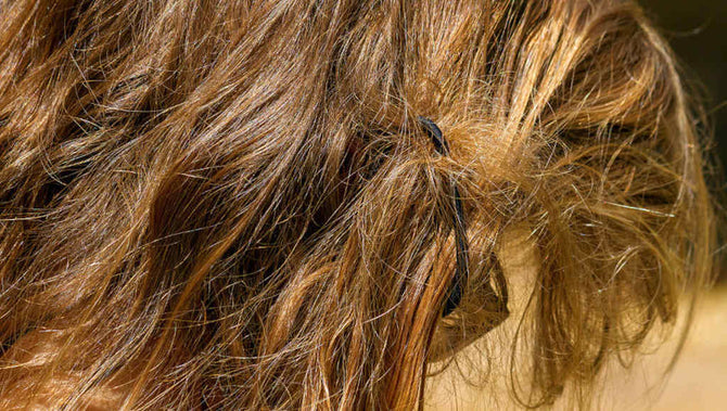 Treat trichonodosis correctly and in a timely manner