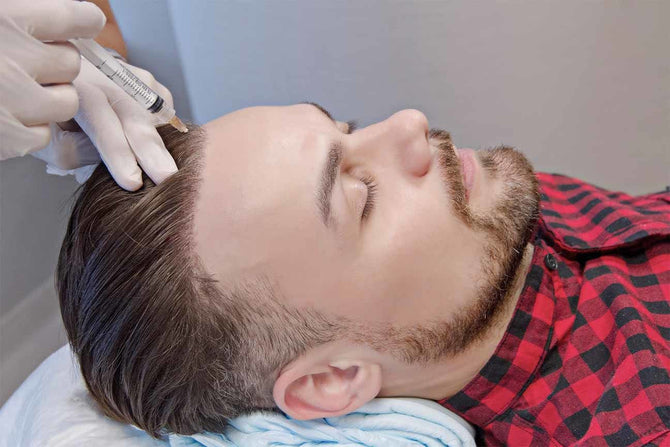 Vampire Lifting against hair loss: An innovative approach to treating hair problems