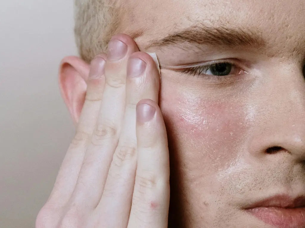 Les pores de la peau peuvent être plus ouvertes selon plusieurs facteurs