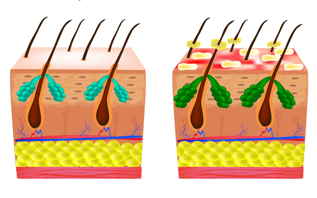 what can be done against hair fungus