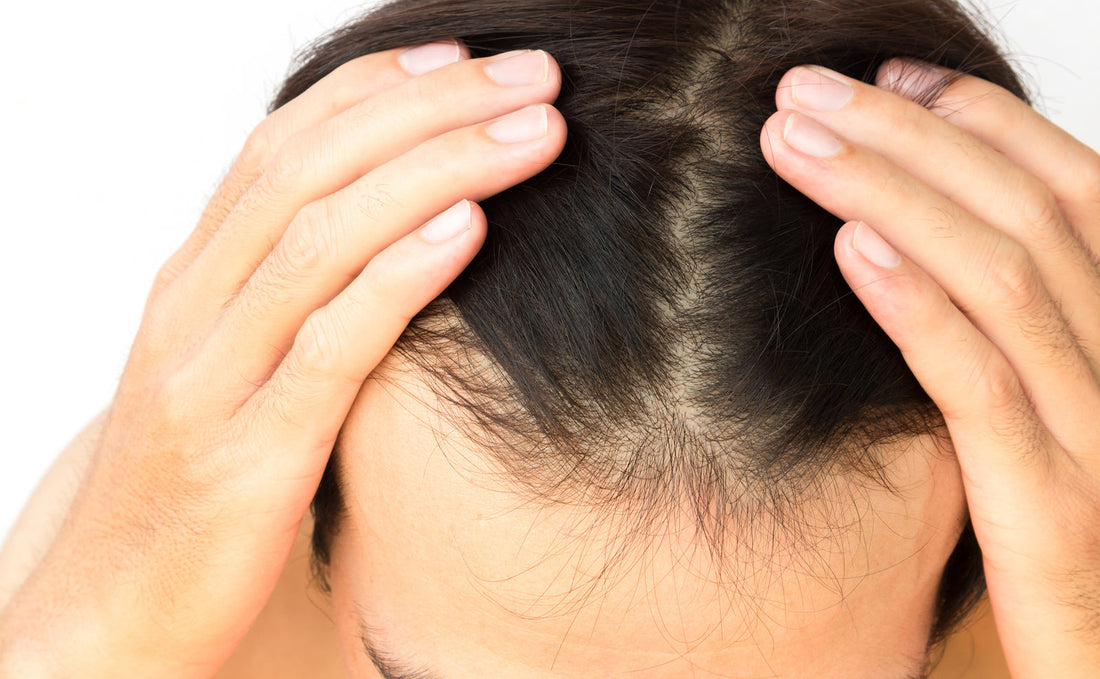 Woman parting hairline checking for covid hair loss