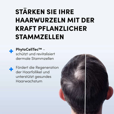 Ein Mann mit lichtem Haar am Hinterkopf, fotografiert von hinten. Darüber steht: "Stärken Sie Ihre Haarwurzeln mit dem Dr. Balwi Meso Therapie Set von Dr. Balwi Shop - für kräftigeres Haar mit PhytoCellTec™, Microneedling und Meso Serum.