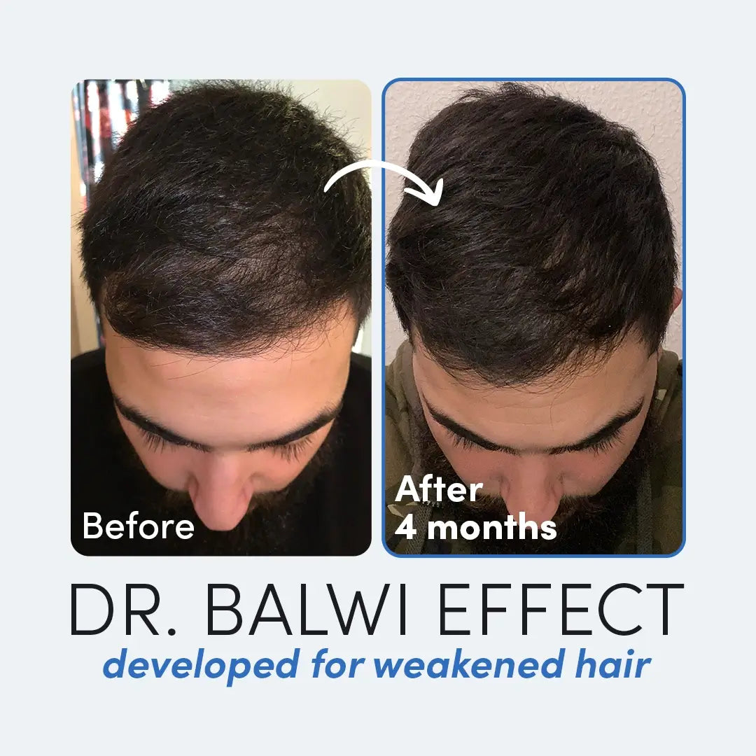 Dr Balwi Aloe Vera Gel