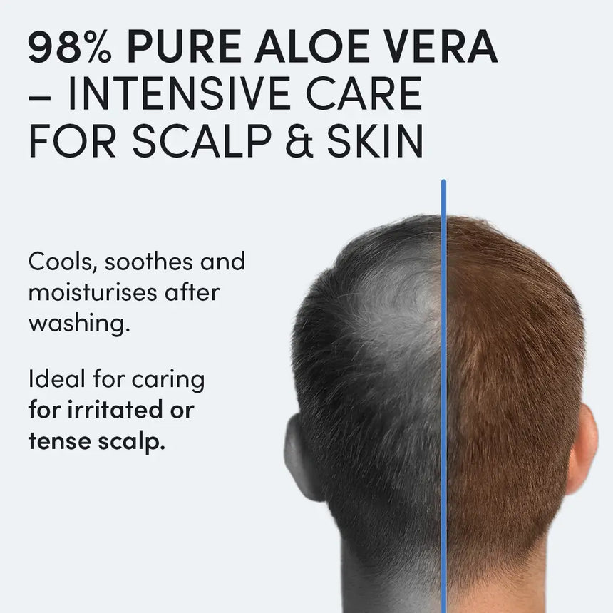 Dr Balwi Aloe Vera Gel