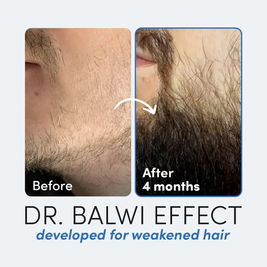 Dr Balwi Beard Serum