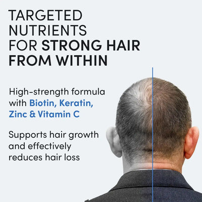 Ein Mann mit schütterem Haar, von hinten gesehen, wird neben einem Text gezeigt, der Nährstoffe für kräftiges Haar anpreist und Biotin, Keratin, Zink und Vitamin C für Haarwachstum und weniger Haarausfall hervorhebt.