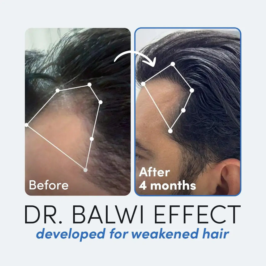 Dr. Balwi Hair Boost Set