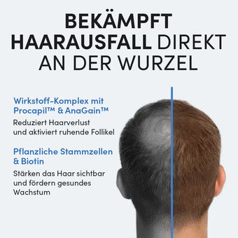 Der Kopf eines Mannes von hinten: links kahle Stellen, rechts dichtes Haar. Deutscher Text wirbt für Dr. Balwi Meso Therapie von Dr. Balwi Shop mit pflanzlichen Stammzellen zur Stimulation des Haarwachstums und zur Vorbeugung von Haarausfall für effektives Nachwachsen.