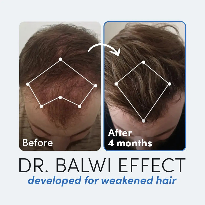 Dr Balwi Mesotherapy Set