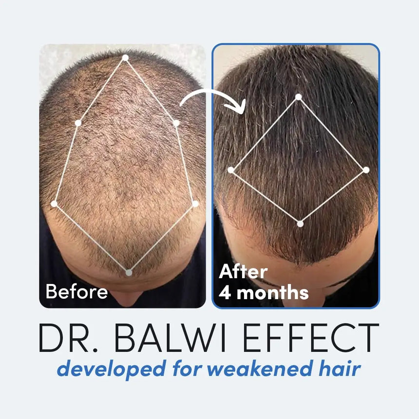 Dr Balwi Hair Serum