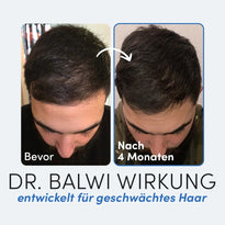 Nebeneinander liegende Fotos von oben: Links, "Bevor", mit schütterem Haar und trockener Kopfhaut; rechts, "Nach 4 Monaten", zeigt volleres Haar. Text: Dr. Balwi Shop - 98% Aloe Vera entwickelt für geschwächtes Haar.