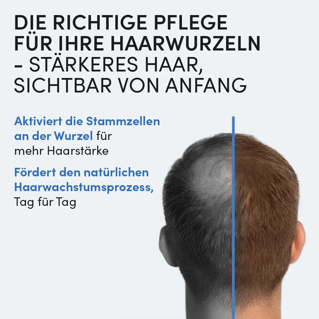 Ein Mann mit schütterem Haar auf der linken und vollem Haar rechts, dazu Text zur Haarpflege mit dem Dr. Balwi Hair Boost Set von Dr. Balwi Shop für die Aktivierung von Stammzellen und den natürlichen Haarwachstumsprozess.