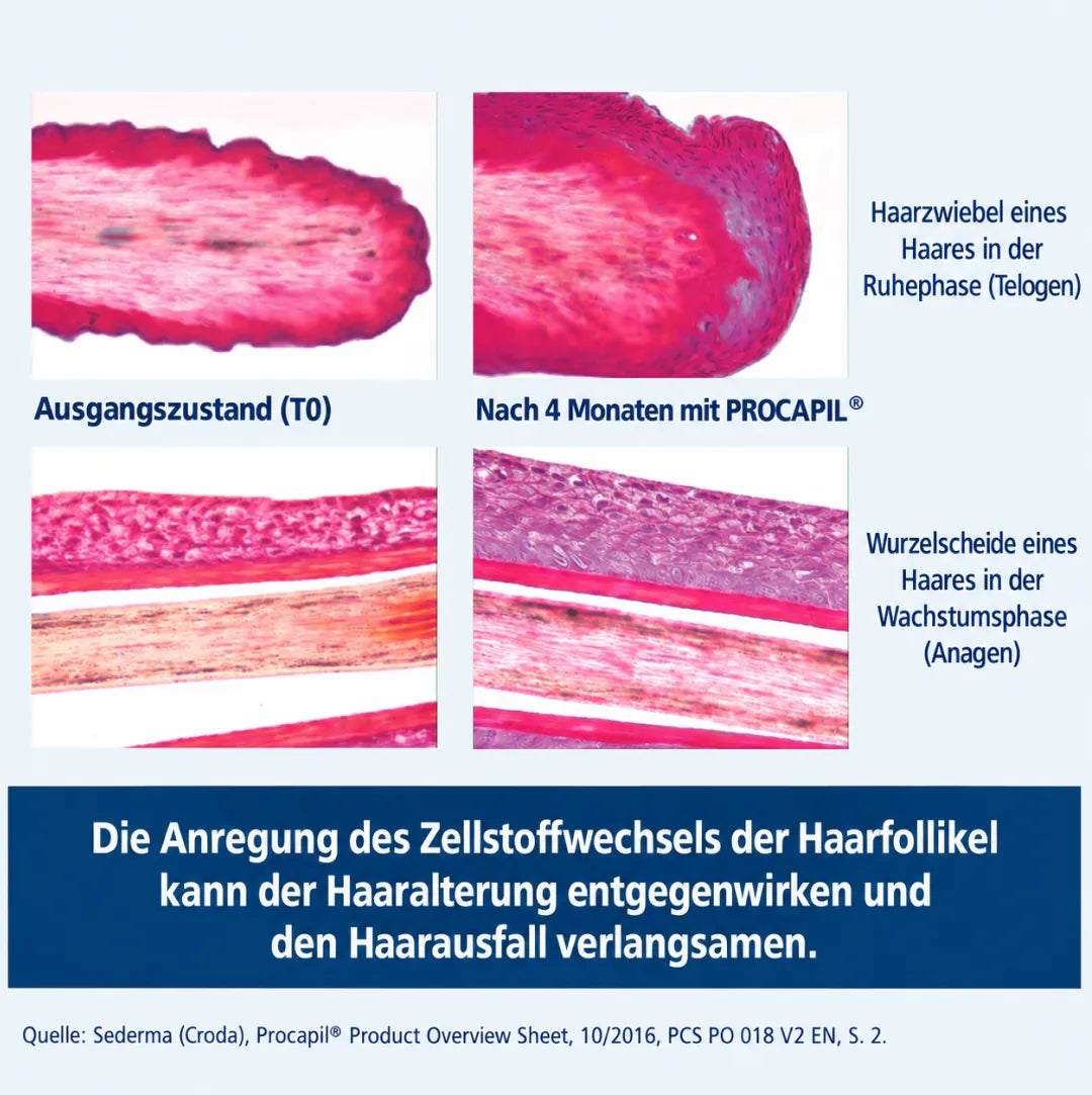 Mikroskopische Aufnahmen, die Haarfollikel vor und nach viermonatiger Anwendung des Dr. Balwi-Shampoos vergleichen und zeigen, wie die Anregung des Zellstoffwechsels durch Procapil die Alterung der Haare und den Haarausfall verlangsamen kann.
