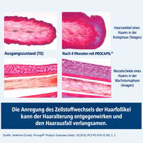 Mikroskopische Aufnahmen, die Haarfollikel vor und nach viermonatiger Anwendung des Dr. Balwi-Shampoos vergleichen und zeigen, wie die Anregung des Zellstoffwechsels durch Procapil die Alterung der Haare und den Haarausfall verlangsamen kann.